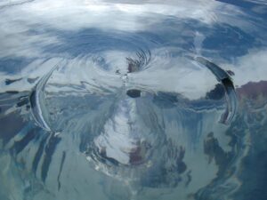 産後脂肪吸引の術後フォローはどのように行うべきですか？
